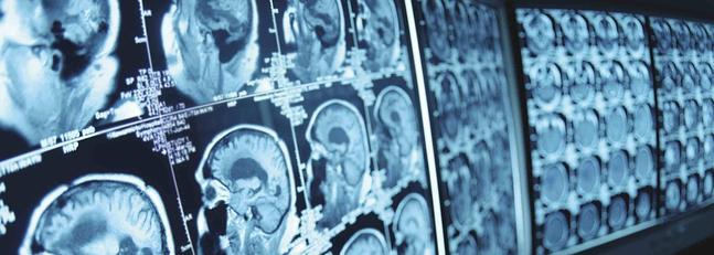 387radiografia-647x231