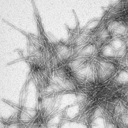 Fibres d’amiloide Aβ42 agregades in vitro i observades al microscopi electrònic.