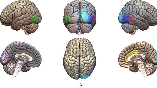 Imágenes del cerebro desde distintos ángulos.