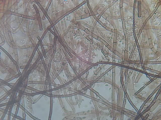 821fungosfilamentososhifasepta