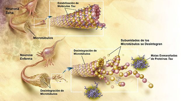 Ejemplo de los cambios estructurales de la proteína Tau durante la enfermedad de Alzheimer. Crédito de imagen: Wikipedia.org