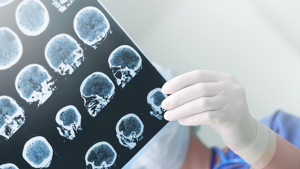 1636imgrquelart20170920-120848imageneslvgettypruebascerebro-km5g-u44263480257wd-992x558lavanguardia