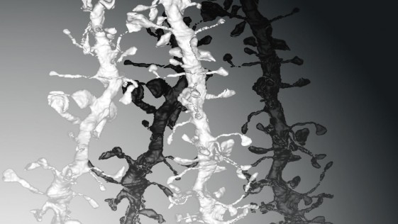 Reconstrucción tridimensional a partir de imágenes de microscopía electrónica de las dendritas, similares a ramas de árboles. En las dendritas hay estructuras en forma de copa llamadas espinas, y en las “puntas” de esas espinas, se forman las sinapsis Crédito: Wisconsin Center for Sleep and Consciousness