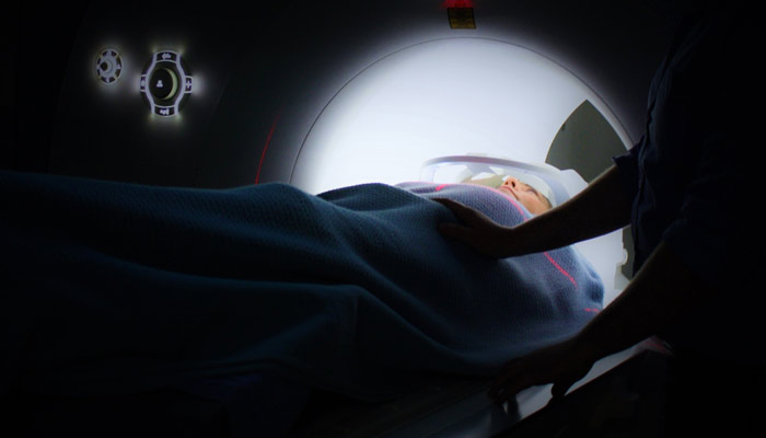 1706causas-deterioro-cognitivo