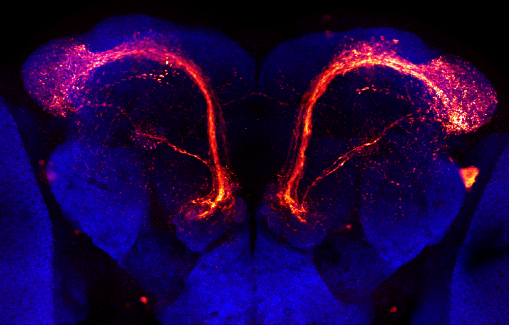 Neuronas vulnerables en el cerebro de la mosca de la fruta. Crédit:TUM Fotostelle.