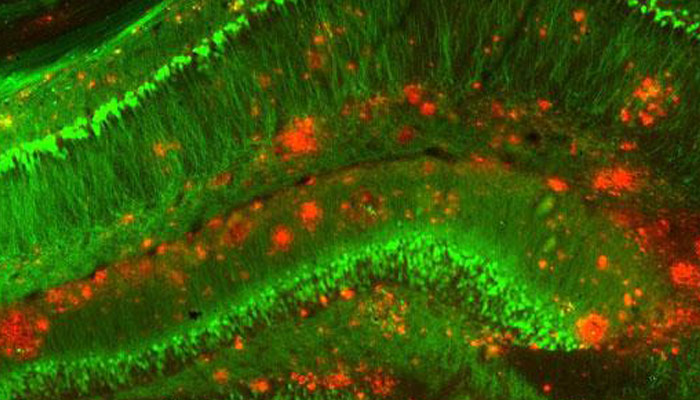 Crédito de imagen: University of Cambridge