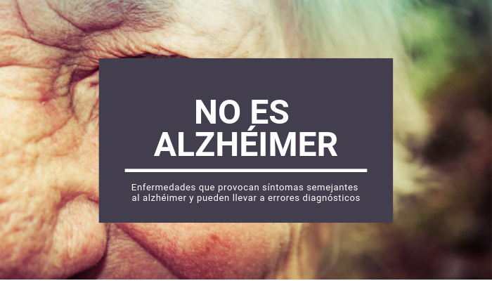 2083diagnostico-diferencial-alzheimer