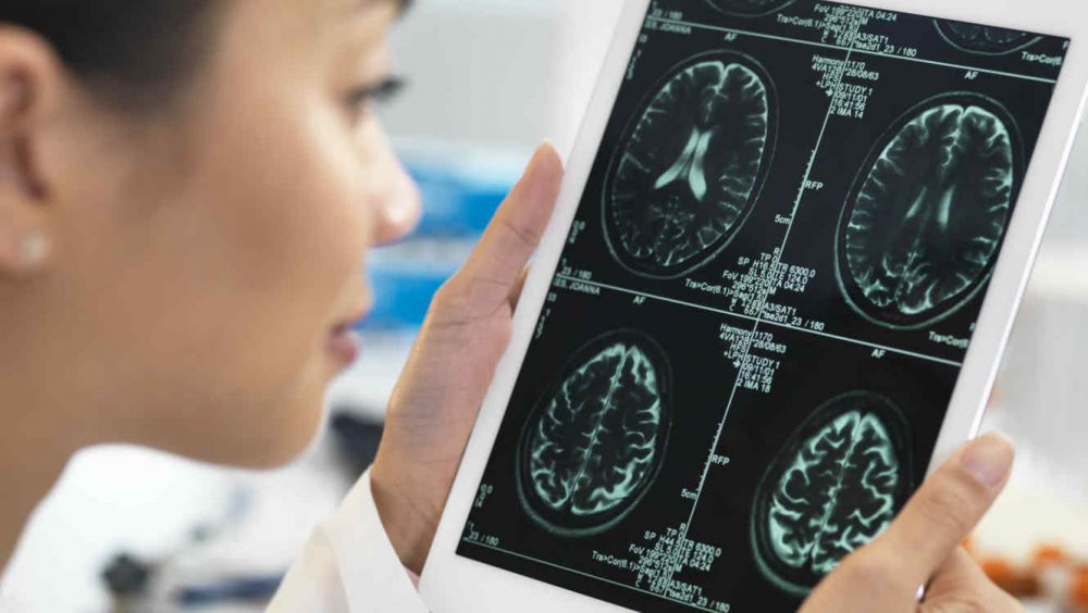 2210cerebro-estudios-cientifica-gettyimages0