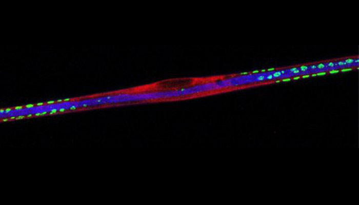 Fibra del nervio ciático. En azul, los neurofilamentos | Prof. Peter Brophy. CC BY