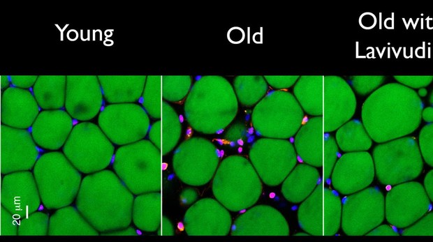 Dos semanas de tratamiento redujeron los signos de inflamación crónica (los glóbulos blancos teñidos de rosa entre las células grasas verdes) en el tejido adiposo del ratón. - Sedivy Lab/Brown University