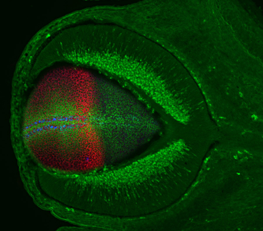 2349dos-proteinas-que-causan-malformaciones-oculares-podrian-estar-relacionadas-con-el-alzheimer