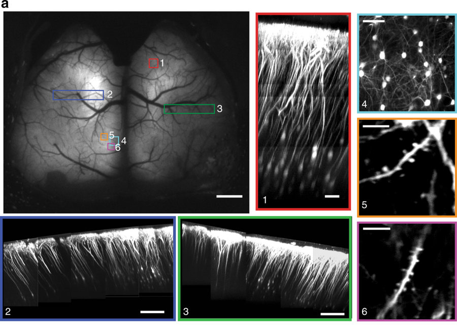 2375craneo-transparente-impresion-3d-3
