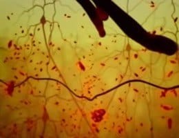 2389proteina-beta-amiloide