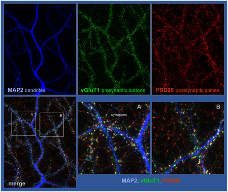 2506una-proteina-cerebral-promueve-la-interconectividad-neuronalimage380