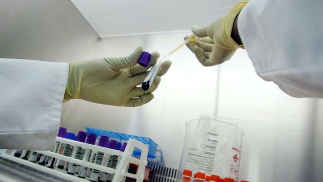 2532analisis-sangre-detectaria-alzheimer-aparicionediima2019080107854