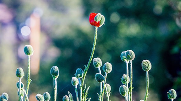 254499900enfermedaddealzheimerlasdiferenciasentreambossexosfotofirstmohican