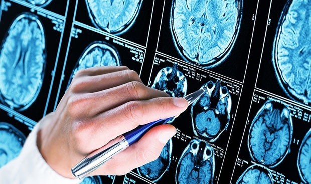 2552consiguen-bloquear-una-proteina-fundamental-en-el-desarrollo-del-alzheimer-3840620x368