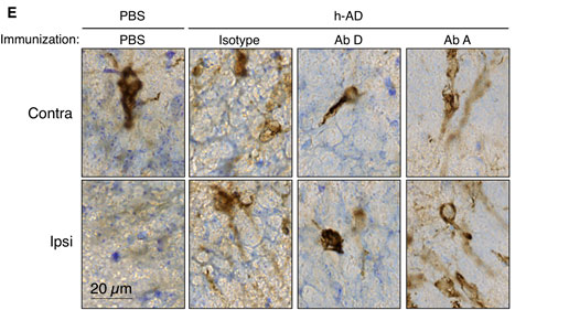 2617geriatricarea-tratamiento-del-alzheimer