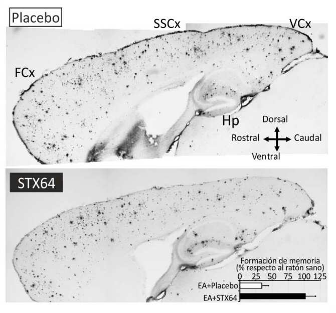 31869021identifican-un-nuevo-farmaco-para-tratar-la-enfermedad-de-alzheimer